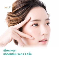 เก็บหางตา แก้รอยย่นหางตา 1 ครั้ง