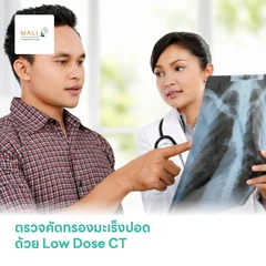 ตรวจคัดกรองมะเร็งปอด ด้วย Low Dose CT