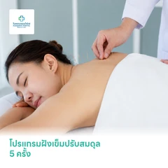 โปรแกรมฝังเข็มปรับสมดุล 5 ครั้ง บริเวณที่ครอบคลุมขึ้นอยู่กับแพทย์ประเมิน