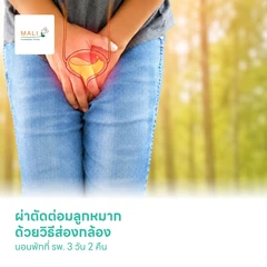 ผ่าตัดต่อมลูกหมาก ด้วยวิธีส่องกล้อง (Transurethral Resection Prostate Gland TUR-P) นอนพักที่ รพ. 3 วัน 2 คืน