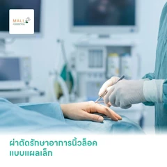 ผ่าตัดรักษาอาการนิ้วล็อค แบบแผลเล็ก (Percutaneous Trigger Finger Release)