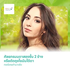 ศัลยกรมมตาสองชั้น 2 ข้าง หรือตัดถุงไขมันใต้ตา กรณีเคยทำมาแล้ว