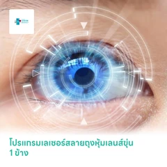 โปรแกรมเลเซอร์สลายถุงหุ้มเลนส์ขุ่น 1 ข้าง