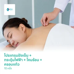 โปรแกรมฝังเข็มลดปวดแผนจีน + กระตุ้นไฟฟ้า + โคมร้อน + ครอบแก้ว 10 ครั้ง