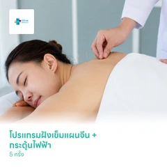 โปรแกรมฝังเข็มแผนจีน + กระตุ้นไฟฟ้า 5 ครั้ง