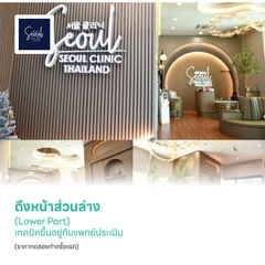 ดึงหน้าส่วนล่าง (Lower Part) เทคนิคขึ้นอยู่กับแพทย์ประเมิน (ราคาทดลองทำครั้งแรก)