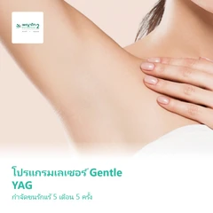 โปรแกรมเลเซอร์ Gentle YAG กำจัดขนรักแร้ 5 เดือน 5 ครั้ง