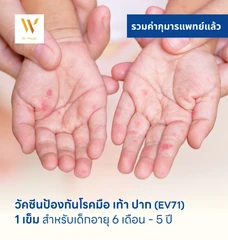 วัคซีนป้องกันโรคมือ เท้า ปาก 1 เข็ม สำหรับเด็กอายุ 6 เดือน-5 ปี