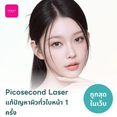 Picosecond Laser แก้ปัญหาผิวทั่วใบหน้า 1 ครั้ง จำกัด 1 ท่านต่อ 1 สิทธิ์ เท่านั้น