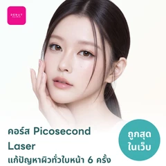 คอร์ส Picosecond Laser แก้ปัญหาผิวทั่วใบหน้า 6 ครั้ง