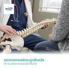 ตรวจเอกซเรย์กระดูกสันหลัง LS Spine (AP , Lat) (20 ปีขึ้นไป)