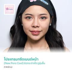 โปรแกรมทรีตเมนต์หน้า (New Pora Cool) ผิวกระจ่างใส ดูชุ่มชื้น (1 สิทธิ์/คน)
