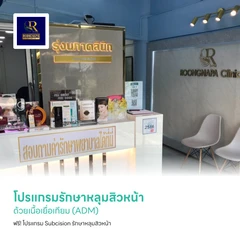 โปรแกรมรักษาหลุมสิวหน้า ด้วยเนื้อเยื่อเทียม (ADM) ฟรี! โปรแกรม Subcision รักษาหลุมสิวหน้า