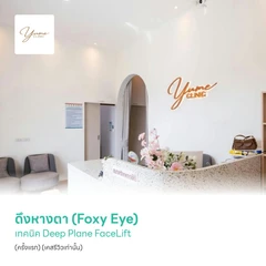 ดึงหางตา (Foxy Eye) เทคนิค Deep Plane FaceLift (ครั้งแรก) (เคสรีวิวเท่านั้น)