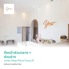 ดึงหน้าส่วนกลาง + ส่วนล่าง เทคนิค Deep Plane FaceLift (ครั้งแรก) (เคสรีวิวเท่านั้น)