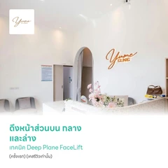 ดึงหน้าส่วนบน กลาง และล่าง เทคนิค Deep Plane FaceLift (ครั้งแรก) (เคสรีวิวเท่านั้น)