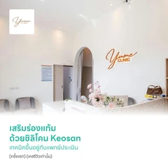 เสริมร่องแก้ม ด้วยซิลิโคน Keosan เทคนิคขึ้นอยู่กับแพทย์ประเมิน (ครั้งแรก) (เคสรีวิวเท่านั้น)
