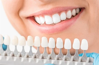 เคลือบผิวฟันและแปะฟันขาว ด้วยวีเนียร์คอมโพสิต 2 ซี่