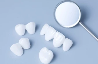 เคลือบผิวฟันและแปะฟันขาว ด้วยวีเนียร์เซรามิกหรือพอร์ซเลน EMax 1 ซี่