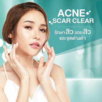 รักษาสิวและรอยสิว 7 ขั้นตอน 1 ครั้ง