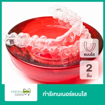 ทำรีเทนเนอร์แบบใส 2 ชิ้น ฟันบนและล่าง