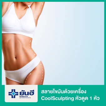 โปรแกรมสลายไขมันด้วยเครื่อง CoolSculpting หัวดูด Cool Core, Cool Courve หรือ Cool Fit 1 หัว