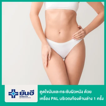 โปรแกรมดูดไขมันและกระชับผิวหนัง ด้วยเครื่อง PAL และ Renuvion บริเวณท้องด้านล่าง 1 ครั้ง