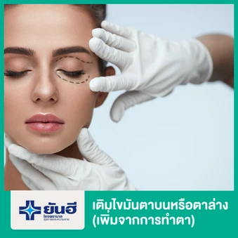 เติมไขมันตาบนหรือตาล่าง (เพิ่มจากการทำตา)