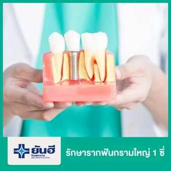 รักษารากฟันกรามใหญ่ 1 ซี่