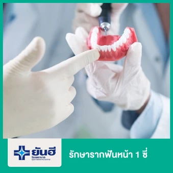 รักษารากฟันหน้า 1 ซี่