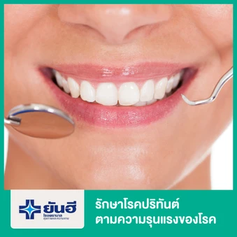 รักษาโรคปริทันต์ ตามความรุนแรงของโรค