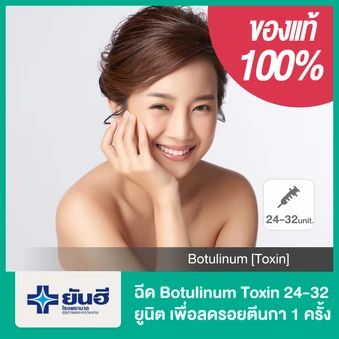 โปรแกรมโบท็อกซ์ 24-32 ยูนิต เพื่อลดรอยตีนกา 1 ครั้ง