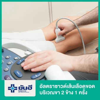 อัลตราซาวด์เส้นเลือดขอดบริเวณขา 2 ข้าง 1 ครั้ง