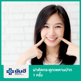 ผ่าตัดกระดูกเพดานปาก 1 ครั้ง