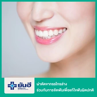 ผ่าตัดขากรรไกรล่าง