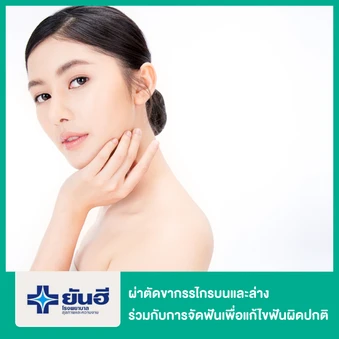 ผ่าตัดขากรรไกรบนและล่าง กรณีทำร่วมกับการจัดฟันเพื่อแก้ไขฟันผิดปกติ