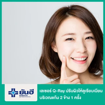 เลเซอร์ Q-Ray ปรับผิวให้ดูเรียบเนียน แก้ปัญหาหลุมสิว บริเวณแก้ม 2 ข้าง 1 ครั้ง