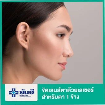 ขัดเลนส์ตาด้วยเลเซอร์ เทคนิค PRK สำหรับตา 1 ข้าง