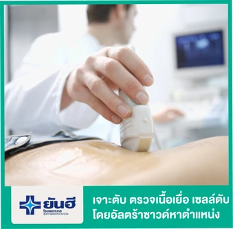 เจาะตับนำเนื้อเยื่อและเซลล์ตับมาวิเคราะห์ โดยอาศัยการอัลตราซาวด์ค้นหาตำแหน่ง (U/S Guides Biopsy)