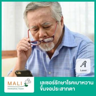 เลเซอร์รักษาโรคเบาหวานขึ้นจอประสาทตา