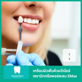 เคลือบผิวฟันและแปะฟันขาว ด้วยวีเนียร์เซรามิกหรือพอร์ซเลน EMax 1 ซี่