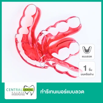 ทำรีเทนเนอร์แบบลวด 1 ชิ้น ฟันบนหรือล่าง