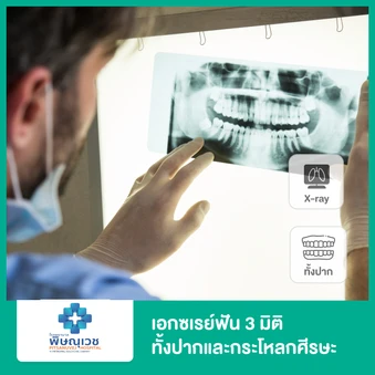 เอกซเรย์ฟัน 3 มิติ ทั้งปากและกะโหลกศีรษะ