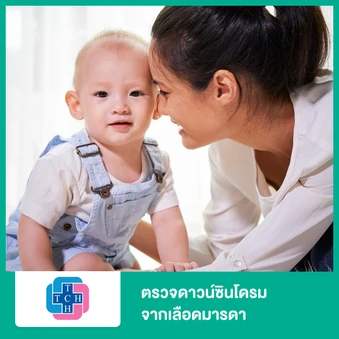 ตรวจดาวน์ซินโดรมจากเลือดมารดา แบบ Harmony Prenatal Test