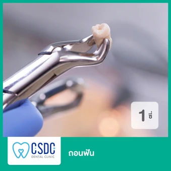 ถอนฟัน 1 ซี่ เฉพาะสาขา ม.เกษตรเท่านั้น