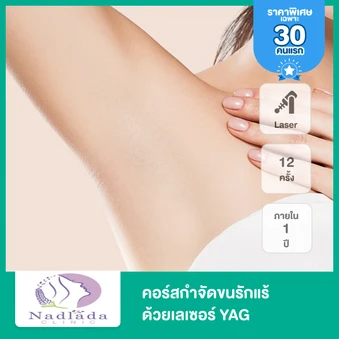 คอร์สเลเซอร์ YAG กำจัดขนรักแร้ 1 ปี 12 ครั้ง