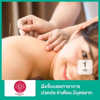 ฝังเข็มบรรเทาอาการปวดประจำเดือน มีบุตรยาก 1 ครั้ง
