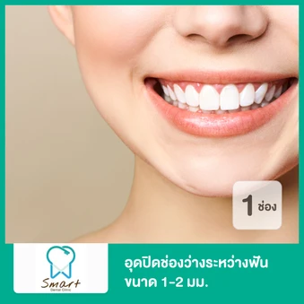 อุดปิดช่องว่างระหว่างฟัน ขนาด 1-2 มม. 1 ช่อง