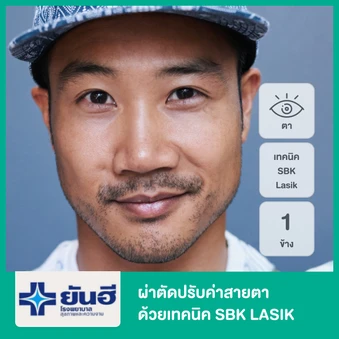 ผ่าตัดปรับค่าสายตา ด้วยเทคนิค SBK LASIK สำหรับตา 1 ข้าง