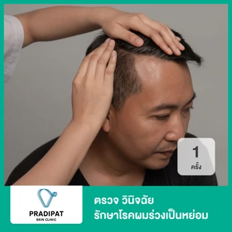 ตรวจ วินิจฉัย รักษาโรคผมร่วงเป็นหย่อม 1 ครั้ง